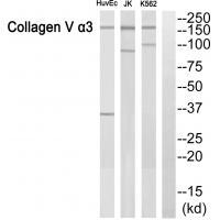 ACTN3 Antibody