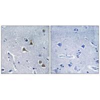 ARRDC2 Antibody