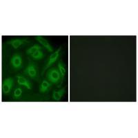 CDH23 Antibody