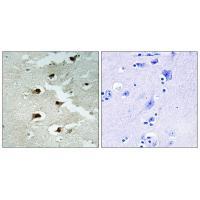 CDCA4 Antibody