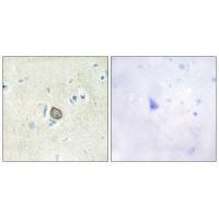CELSR3 Antibody