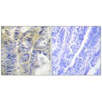 Collagen IV α5 Antibody