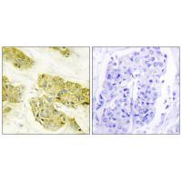Collagen V α3 Antibody