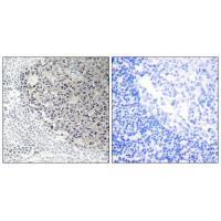Collagen IX α3 Antibody