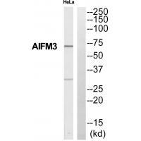 Collagen XI alpha Antibody