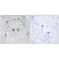Collagen XI α2 Antibody