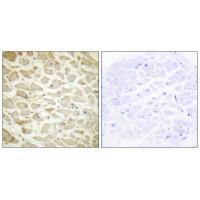 Collagen XIV α1 Antibody
