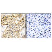 Collagen XVIII α1 Antibody