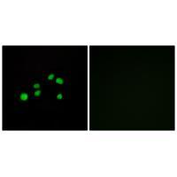 Collagen XXIII α1 Antibody