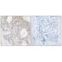 Cytochrome P450 1A2 Antibody