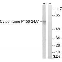 Cytochrome P450 24A1 Antibody