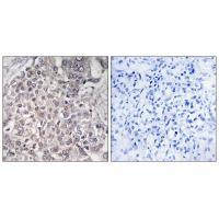 Cytochrome P450 4F2 Antibody