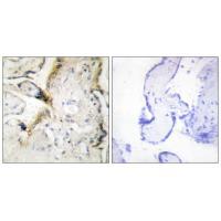 LAMA2 Antibody