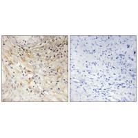 LAMB3 Antibody