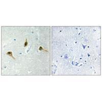 MSH2 Antibody