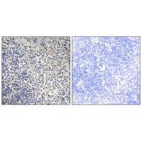 TPIP1 Antibody