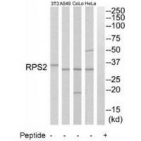 RPS2 Antibody