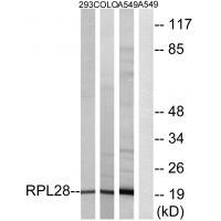 RPL28 Antibody
