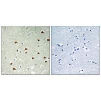 ABHD14B Antibody