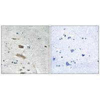 ABHD4 Antibody