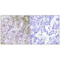 ACOT12 Antibody