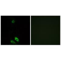 AKR1CL1 Antibody