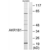 AKR1B1 Antibody
