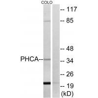 PHCA Antibody