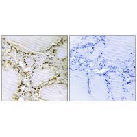AMPD1 Antibody