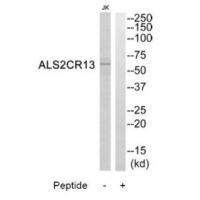 ALS2CR13 Antibody