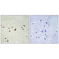 ANKRD26 Antibody