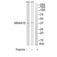 ANXA10 Antibody