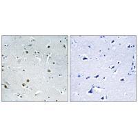 DDX24 Antibody