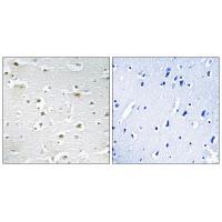 DDX3Y Antibody