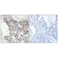 BAGE4 Antibody