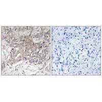 GCNT3 Antibody