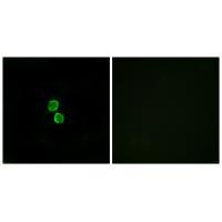 CKLF1 Antibody