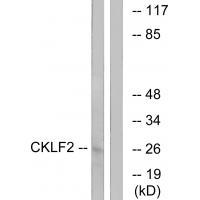 CKLF2 Antibody