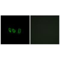 CSTL1 Antibody