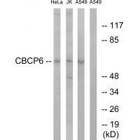 CBCP6 Antibody