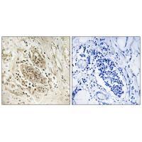Myc Antibody