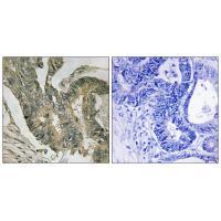ALDOC Antibody