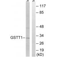 GSTT1/4 Antibody