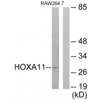 HOXA11/D11 Antibody