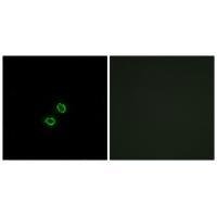 KIR2DL5B Antibody