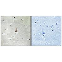 LRP10 Antibody