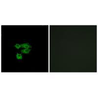 LY6E Antibody