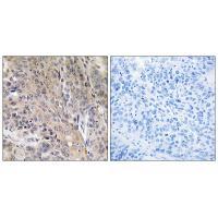 LAMP3 Antibody