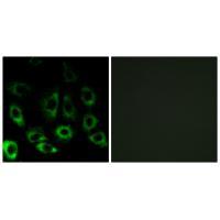 MBTPS2 Antibody