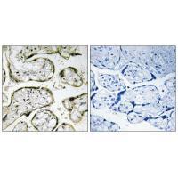 MRPS32 Antibody